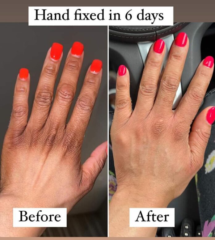 Khanyi Mbau Has Finally Fixed Her Hands Style You 7