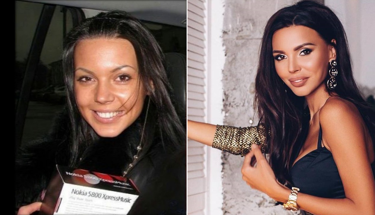 Оксана самойлова фото до и после пластики и без макияжа