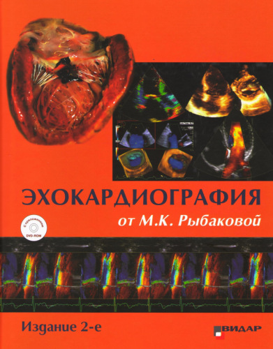 Кардиология - Рыбакова М.К. - Эхокардиография от М.К. Рыбаковой. 2-е издание (2018) PDF