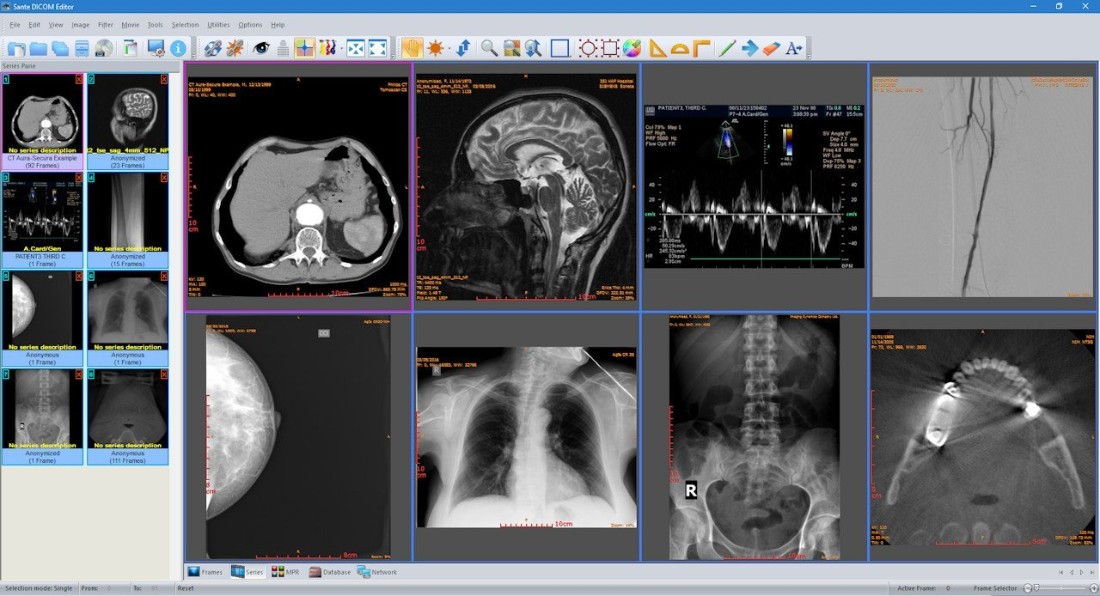 Sante DICOM Editor 10.0.4 603aaca87439c6d02279aa4059db85c1